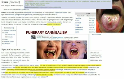bryli - #pizzagate a co wy na to że Clinton jest chora na kuru? https://pl.m.wikipedi...