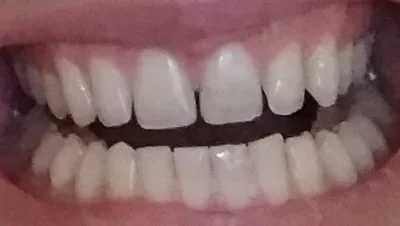rales - Ząbki do oceny
#dentysta #stomatologia #zeby