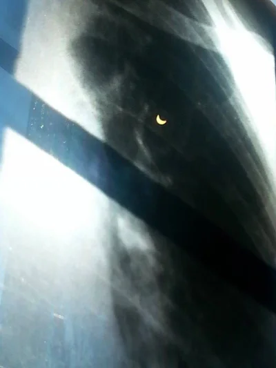 hpiotrekh - Mama wysyła mi zdjęcie zaćmienia zrobione na rentgenie xD 

( ͡° ͜ʖ ͡°)...