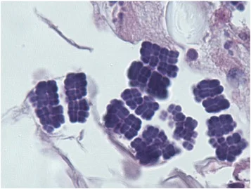 Buxbaumia - Wiecie, że Helicobacter pylori nie jest jedyną bakterią, która może przeż...
