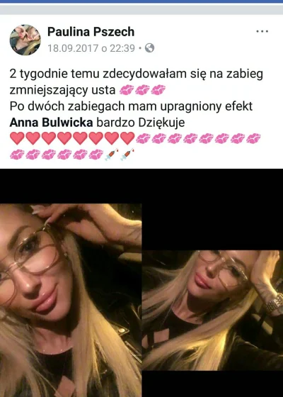 Lissa - najpierw powiększyła, potem pomniejsza, co ta kobieta ma w głowie (╥﹏╥)