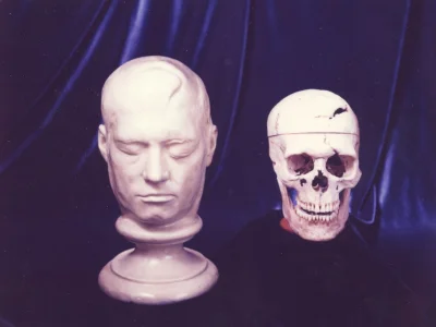 GreaterManchesterbusroute58 - Skull and life mask of Phineas Gage, Warren Anatomical ...