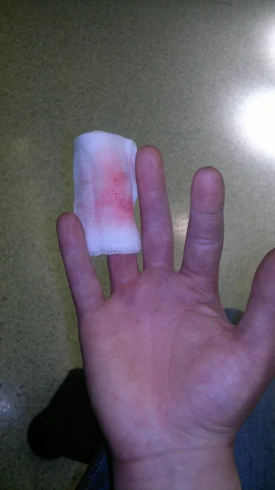 Altru - #pokazpalec #szpital #zalesie

Straciłem większość skóry na palcu. Dajcie k...