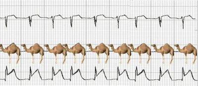 SoNuS - Dla tych których jeszcze ciekawi zapis zawału w ekg (Forma ilustrejszyn)

#ra...