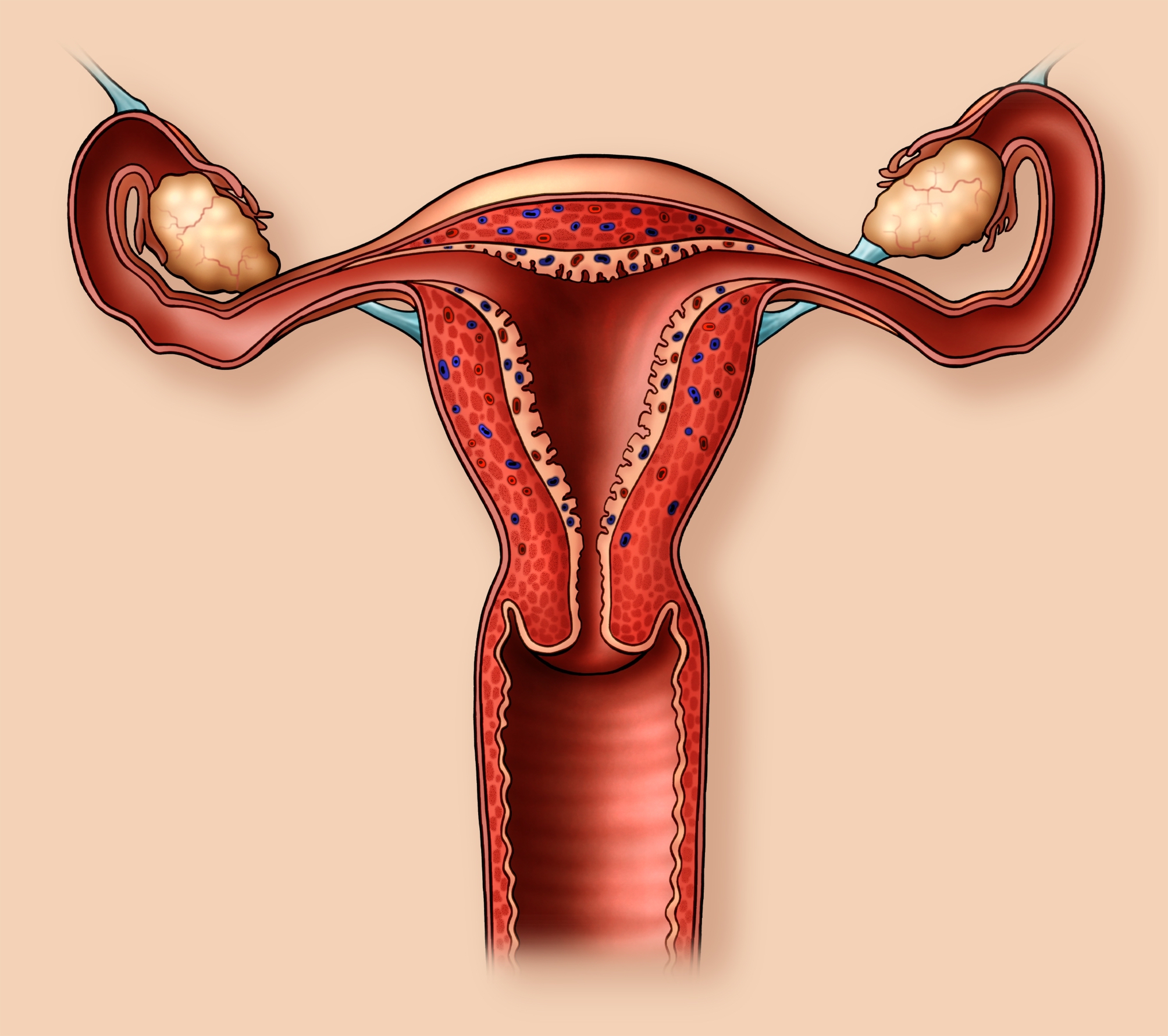 Аномалии репродуктивной системы женщины