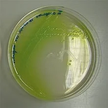 mlodysum - Pseudomonas aeruginosa vide pałeczka ropy blekitnej

Jest to jeden z zapac...