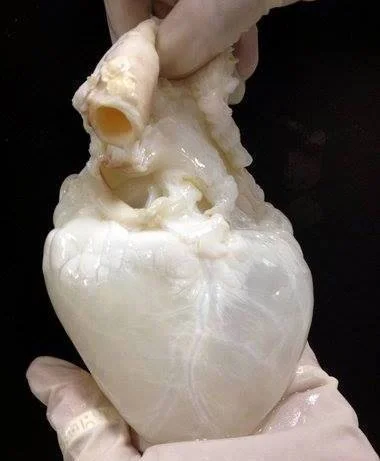 semperfidelis - Medyczne ciekawostki cz. 1:



GHOST HEART - Serce pozbawione komórek...