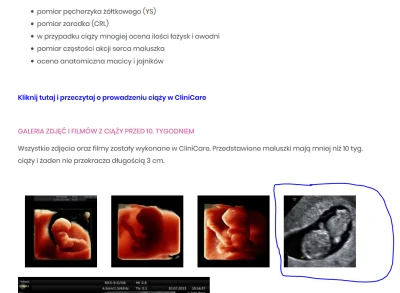 gucias - @Dusiaklaudusia: Na stronie clinicare.pl ukradli Twoje zdjęcie, ale spokojni...