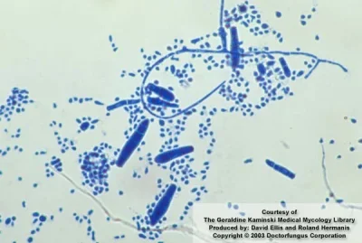 ItTookTheNightToBelieve - $trichophyton $brucella -ACF
F?ymbols