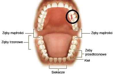 Mawak - pęk mi ząb, do rana wytrzymam?
#zeby #stomatologia #przegryw