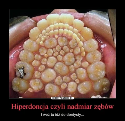 pelzajacy_slimak - To uczucie, gdy ktoś z hiperdoncją ma zdrowsze zęby niż ja. ( ͡° ʖ...