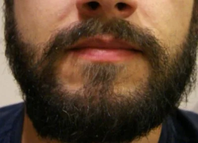 riccardo - @kaznodzieya: A co byście poradzili na taką brodę?