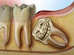 QBA__ - Mirony wczoraj byłem u dentystki, bo w sumie to mnie ząb już tydzień boli, a ...