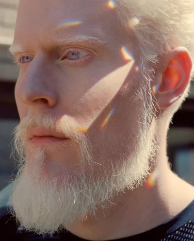 DumnaAniemia - Chcielibyście być albinosami?
#przegryw #stulejacontent #niebieskiepa...