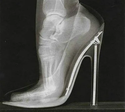 spion999 - Zdjęcie rentgenowskie stopy obutej w szpilki ( ͡º ͜ʖ͡º) Ładne to to możne ...