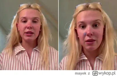 mayek - @niegwynebleid: Ja myślę, że to jednak chuiowe angielskie geny