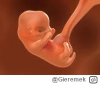 Gieremek - >Usuwanie zdrowych ciąż jest zwykłym morderstwem

@Malutor: Definicja mord...