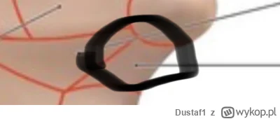 Dustaf1 - Od kilku dni zauważyłem u siebie problem z dolną szczęką przy otwieraniu us...