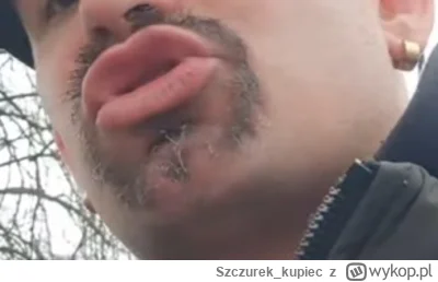 Szczurek_kupiec - #bonzo  trochę edukacji 
Odbytnica, prostnica (łac. rectum), jelito...