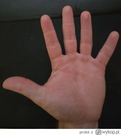 prolol - 3 miesiące masy i robienia przedramienia prawie codziennie, dłonie i palce r...
