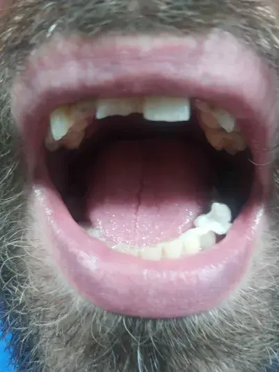 HorrorystycznyDemonPagona - czy z taką linią zębów mam szanse na związek?

#przegryw ...