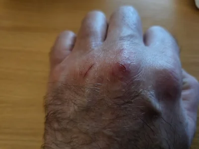 staryhuop0 - #przegryw 
Znowu mi skóra popękała.
Trzeba kremem smarować.