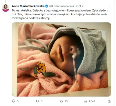 danni12 - @martina1423: Jak zajdziesz w ciąże z bezczaszkowym i bezmózgowym płodem a ...