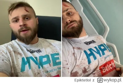 Epiktetlol - Ferrari vs P---s to może być starcie stulecia. Konferencja może skończyć...