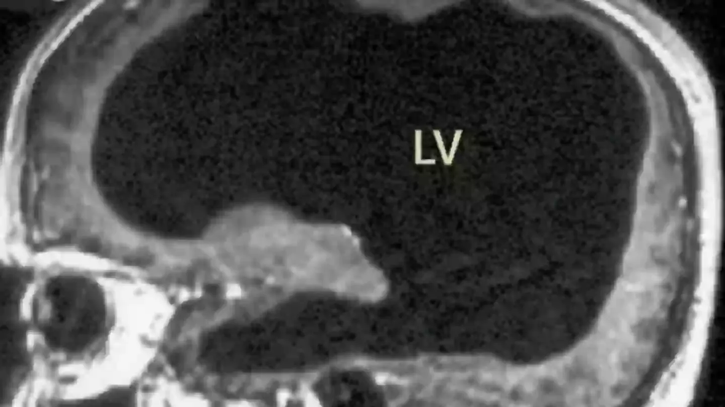 Relaxpls - @Malgorzatabezrak: