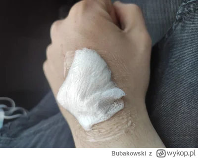 Bubakowski - Ehhh, miałem badanie podczas którego mieli mnie uśpić, uśpili ale tak po...
