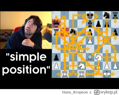 Hans_Kropson - >a 3000 wygląda tak:

@5da4266d3de6dbaf425a2d4fc16225d0: 

https://you...