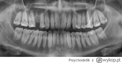 Psychodelik - Czy są gdzieś jakieś konsultacje online co do zdjęcia RTG zębów?
Po zak...