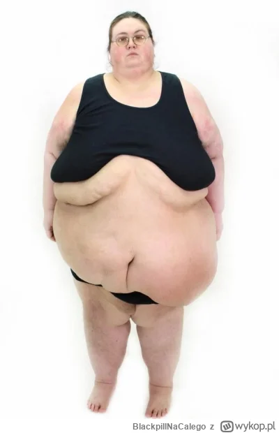 BlackpillNaCalego - @se_mallo:  tymczasem ,, lekko odstający brzuch "