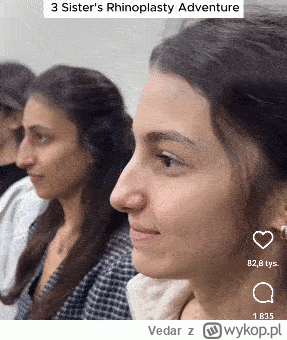 Vedar - trzy siostry zdecydowały się na operację nosa by polepszyć swoje życie i zwię...