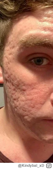 K.....D - @Bubakowski Ten z filmu chłopaki nie płaczą ale to było bardzo dawno temu. ...