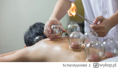 Schizotypoidal - C--j, trzeba było się od babki nauczyć stawiać bańki i bym teraz na ...