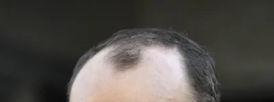 Hadolf_Itler - #f1 RONDE DI ZAKOLA