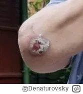 D.....y - @jaaktozbyinny: Łokcie powiadasz? Konon miał łokcie w REWELACYJNYM stanie j...