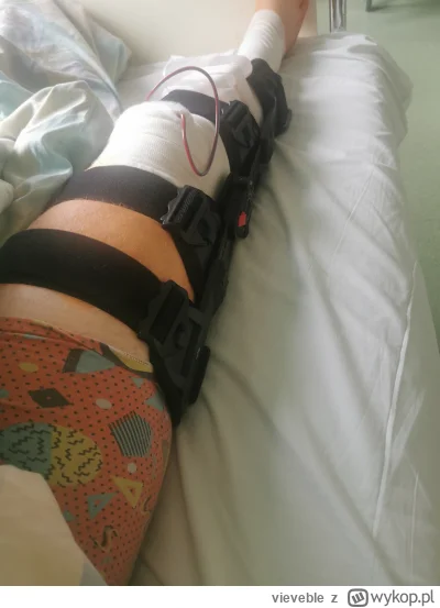 vieveble - Żyje, stulejka usunięta.