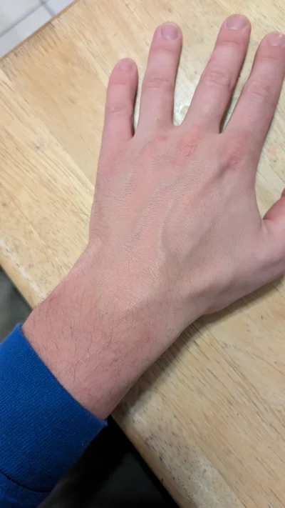 Runaway28 - @FrozenShade: testo mam okej, mam cienki układ kostny. 

 @eMaTee  taki m...