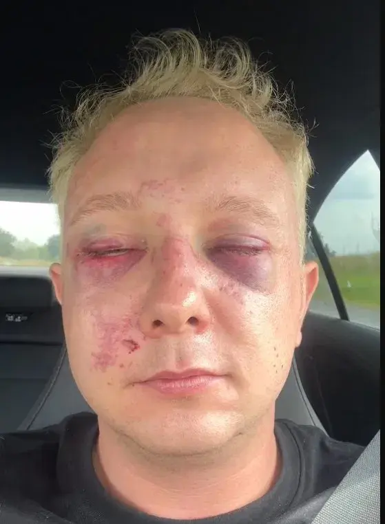 dam115 - @Rafonixkozak2008Pl Toruń