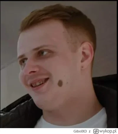 GibolXD - #famemma Plamę na mordzie masz, bo miejsca zabrakło ci już na honorze