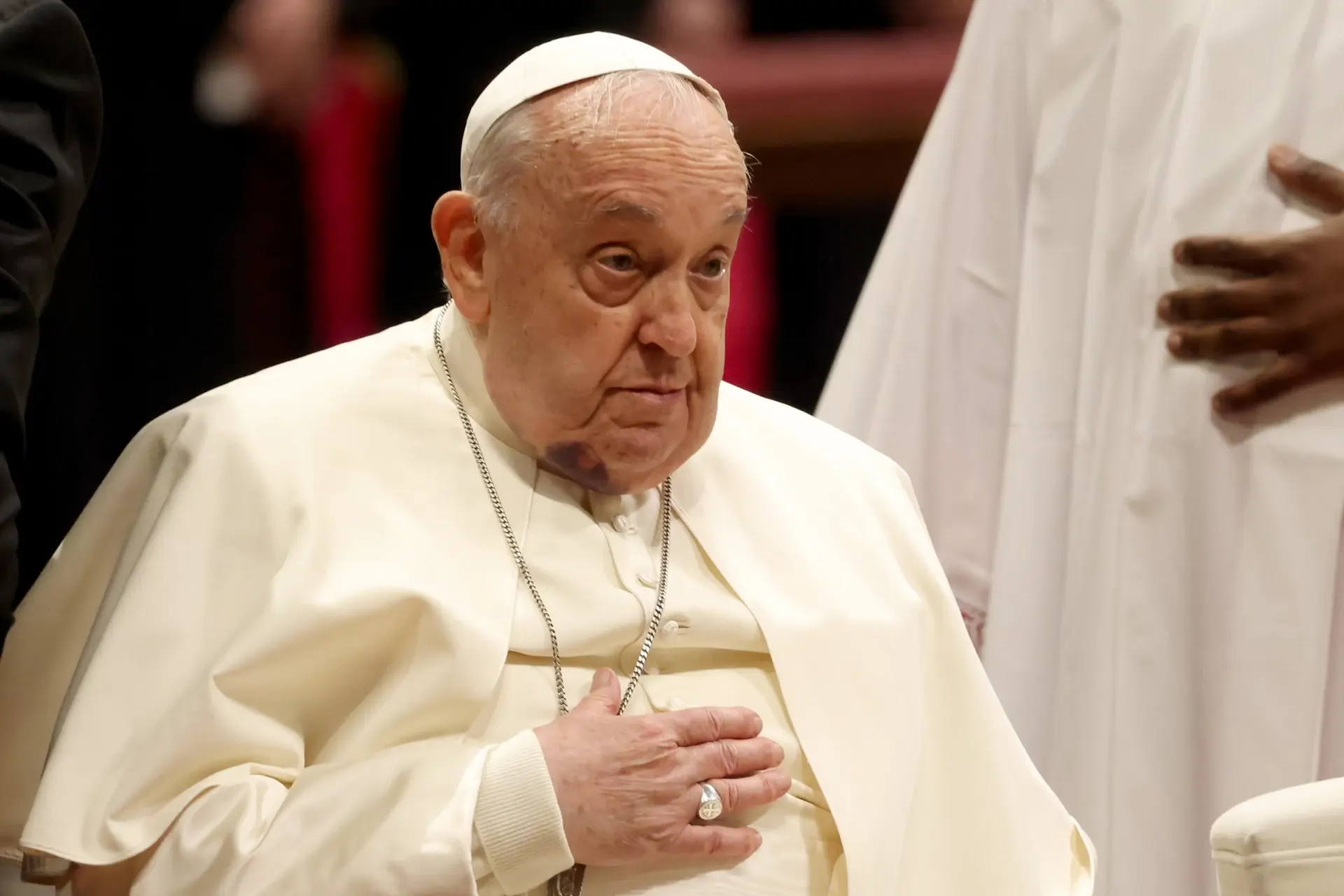 F.....L - Smucę się stanem zdrowia papieża
#przemyslenia #oswiadczenie #papiez #kosci...