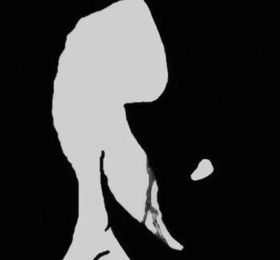 malyatakpaniki - #przegryw