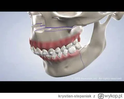 krystian-stepaniak - @gjaowdhjce: jeszcze to ( ͡° ͜ʖ ͡°)