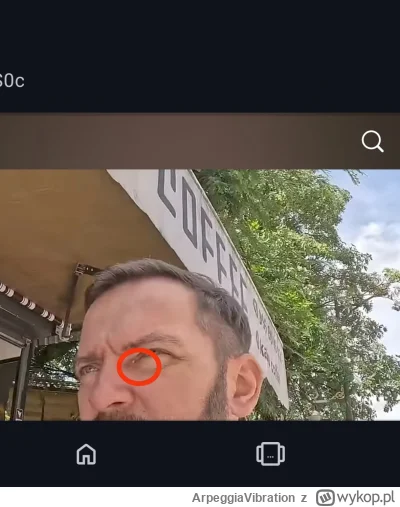ArpeggiaVibration - #raportzpanstwasrodka #popaswpieprz Gapie ropień, jęczmień czy in...