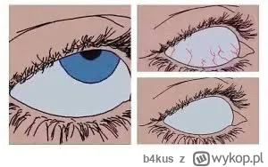 b4kus - @Uriel0987 cóż za oryginalna myśl wyk0pka