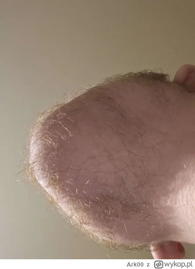 Ark00 - Piękny dostojny zarost godny wikinga. A wy co, pewnie łoniaki na mordzie co n...