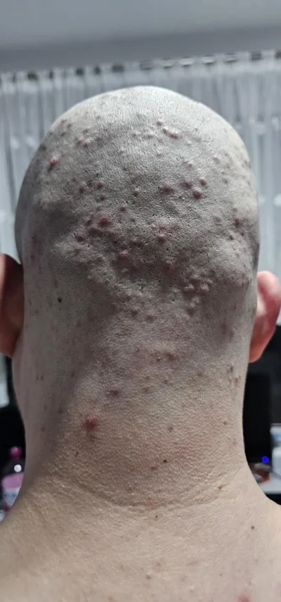 heksengerg - Byłem wczoraj u Pana barbera za 130 zł strzyżenie.
Nie polecam. 
Teraz m...