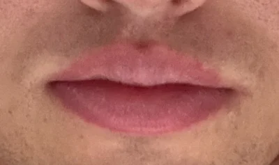 kamileon25 - Wiem że jestem singlem przez wzrost ale moim osobistym kompleksem jest t...